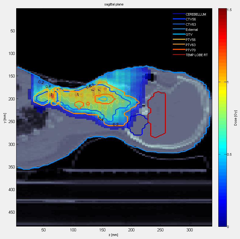 ../_images/doseVisSagitalIntensity.png